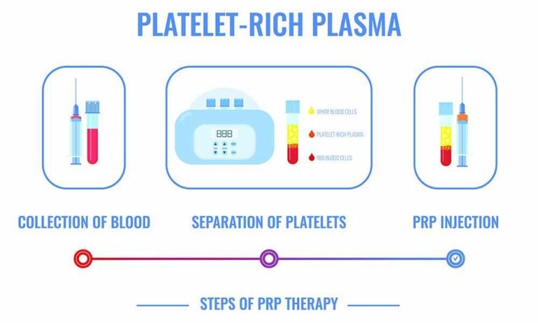 How does PRP work?