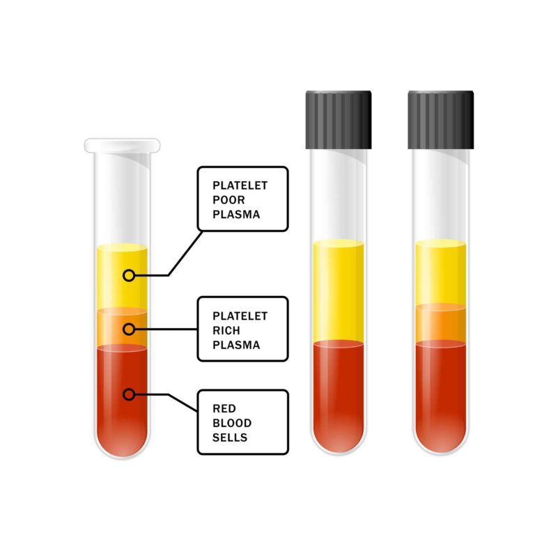 (Platelet Rich Plasma) PRP Cosmetic Treatment Guide