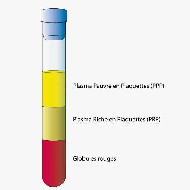 What is the best centrifugation protocol for making PRP?