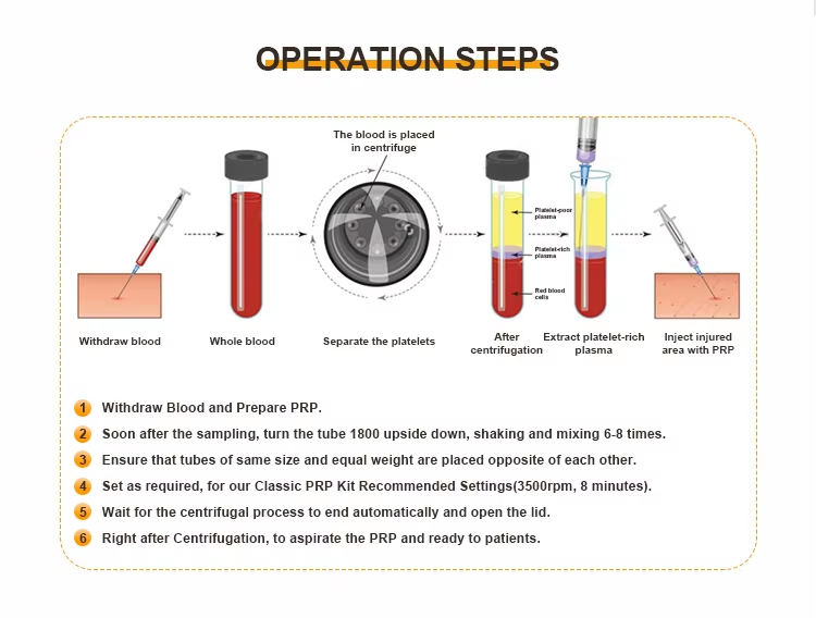 Veterinary PRP centrifuge