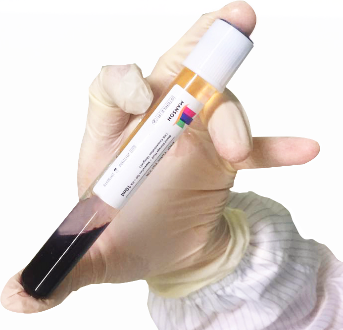 The Critical Role of Tube Selection in PRP Preparation